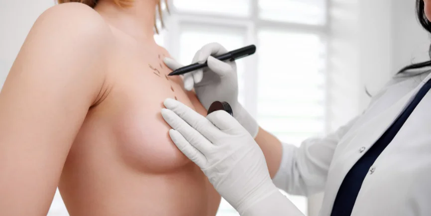 Mastektomi Cerrahi Teknikleri