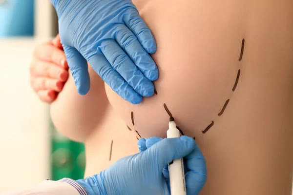 Mastektomi Cerrahi Teknikleri