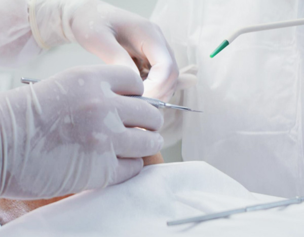 Paratiroit Cerrahisi